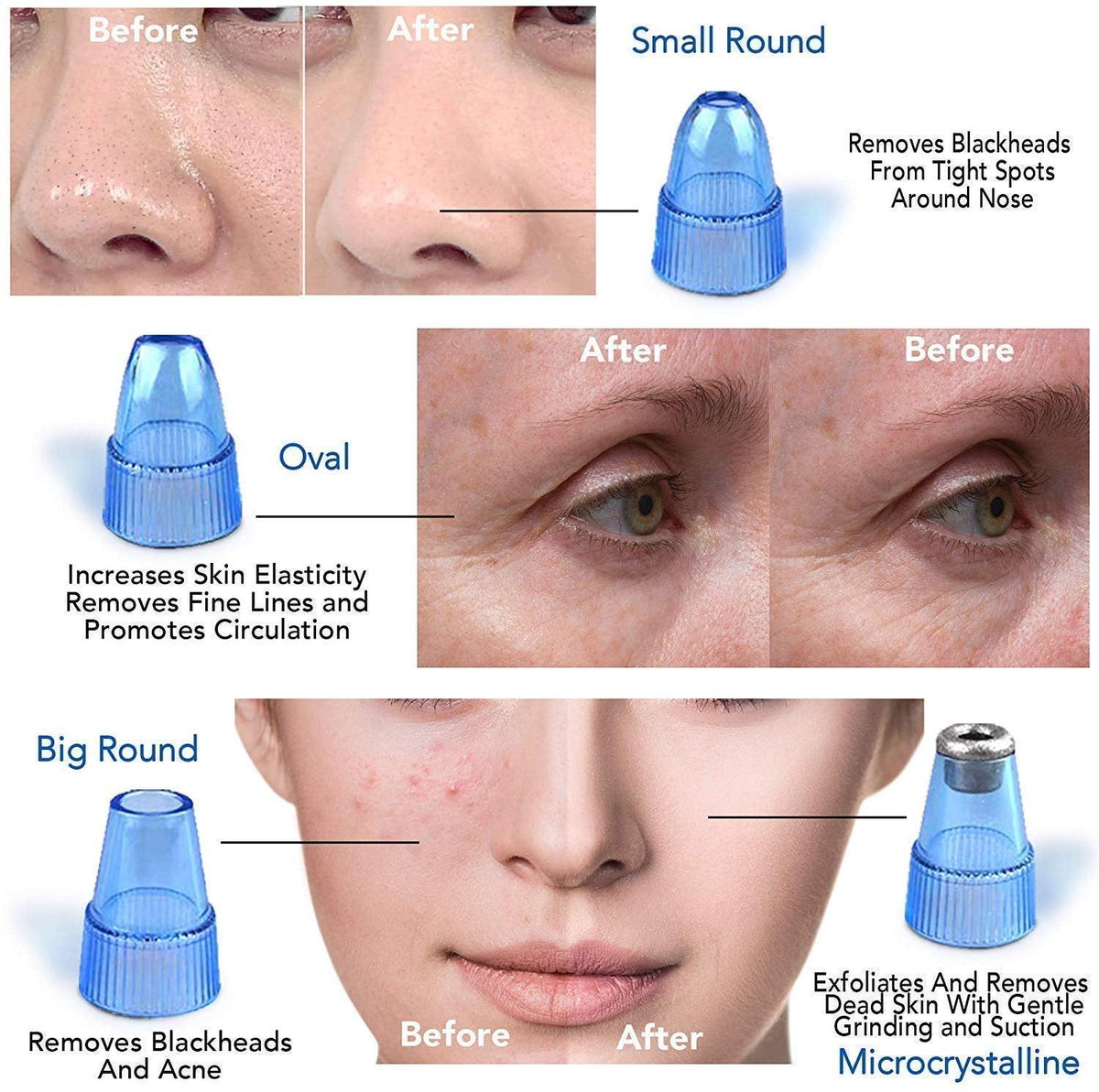 Pore Cleaning Device