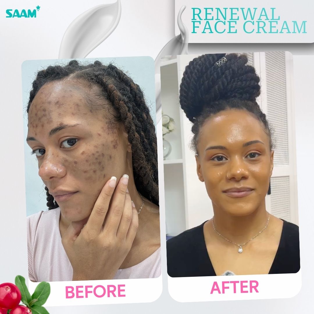 SAAM Renewal Face Cream Original | Daily Moisturizing & Skin Repair Cream